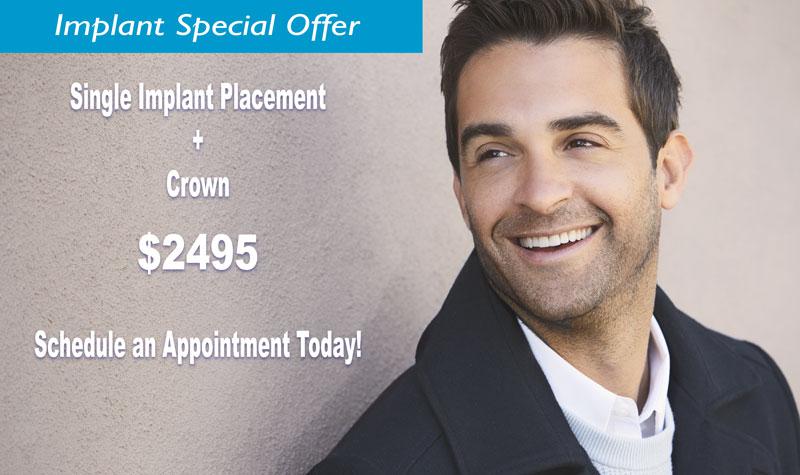 Dental Implant Special Offer | San Diego